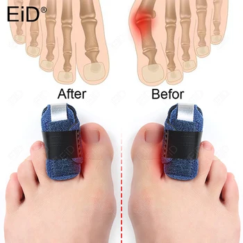 EiD Toe Шина за Изправяне на Пръстите на Краката се Обвиват за Крака с Загнутым Нокът и Криви Пръсти, за привеждане в съответствие и подкрепа на Пръстите Инструмент за грижа за краката Унисекс